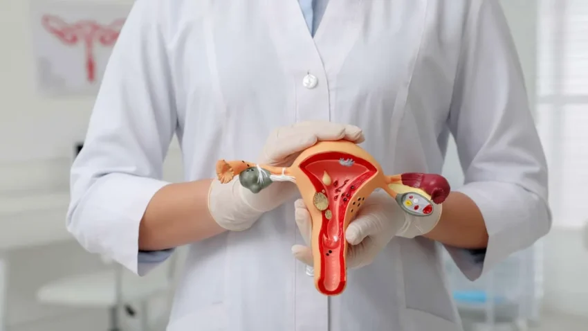 Mengenal Lebih Dekat Kanker Endometrium Penyebab Kematian Dina Mariana